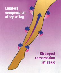 compression stocking compression stocking