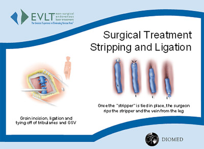 laser-surgical-treatment