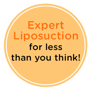 abdominal liposuction