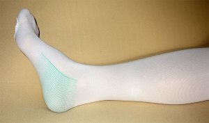 A picture of compression stockings for lipedema