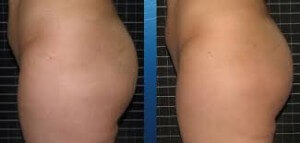 Butt Aug 2