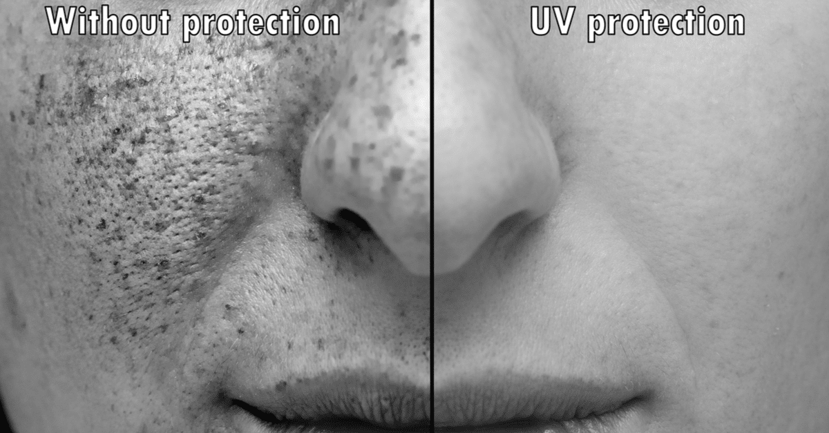 skin cancer