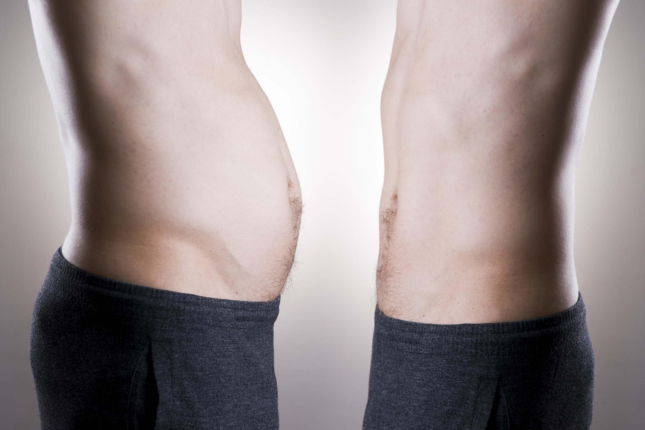 Liposuction procedures