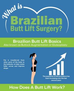 Brazilian Butt Lift Infographic 246x300