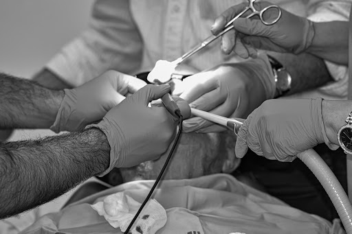 Outpatient vs. Inpatient Liposuction11